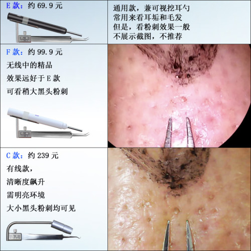 可視粉刺針高清黑頭夾細胞夾顯微鏡粉刺夾微距無線攝影機去痘神器