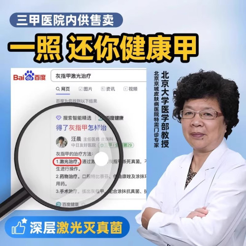灰指甲光療機真菌燈紅外線雷射腳指甲治理療儀工具灰甲智能光療儀