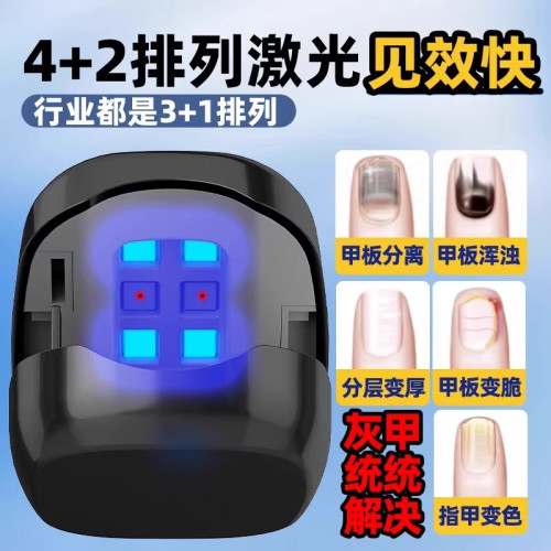 灰指甲光療機真菌燈紅外線雷射腳指甲治理療儀工具灰甲智能光療儀