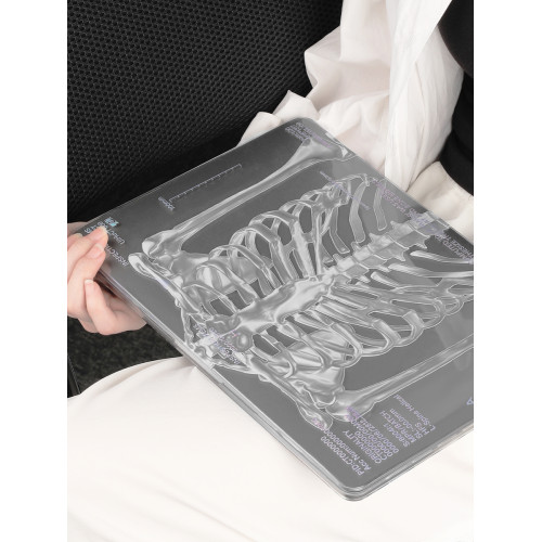 MIUCHO 人體骨架電腦殼適用蘋果26新款M5鐳射air13透明macbook14磨砂pro原創設計防摔pro16寸防磕碰保護硬殼
